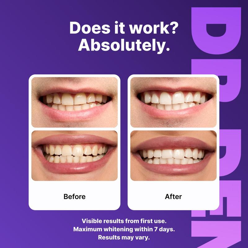 Purple Teeth Whitening Strips