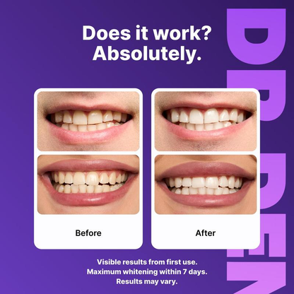 Purple Teeth Whitening Strips
